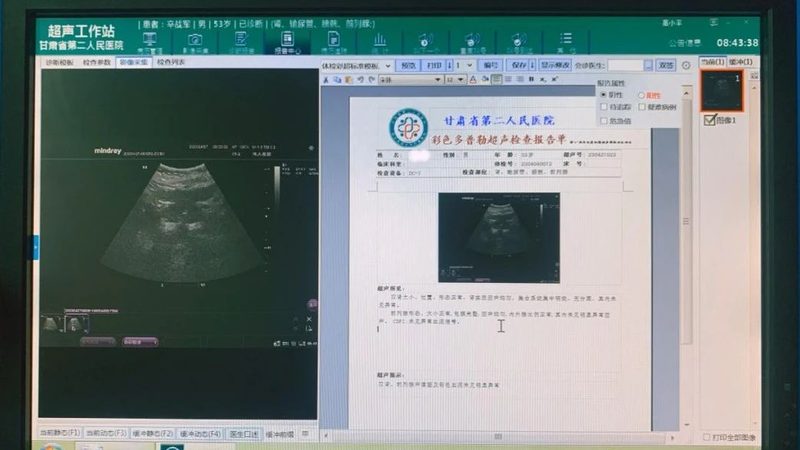 女性体检标准项目规范最新版